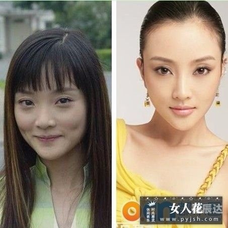 徐海星整容前后徐海星整容前后对比-第1张图片