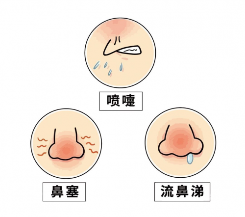 喷嚏测吉凶喷嚏测吉凶-第2张图片